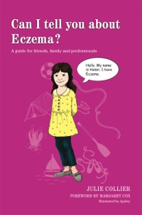 Omslagafbeelding: Can I tell you about Eczema? 9781849055642