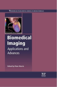 Cover image: Biomedical Imaging: Applications and Advances 9780857091277