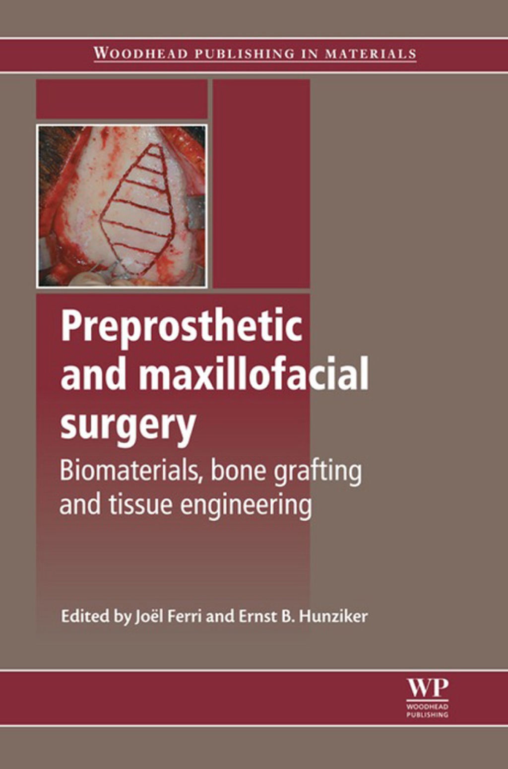 Preprosthetic and Maxillofacial Surgery: Biomaterials, Bone Grafting And Tissue Engineering