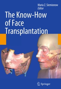 صورة الغلاف: The Know-How of Face Transplantation 9780857292520