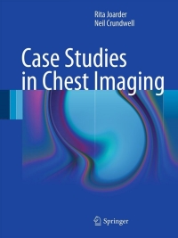 صورة الغلاف: Case Studies in Chest Imaging 9780857298379
