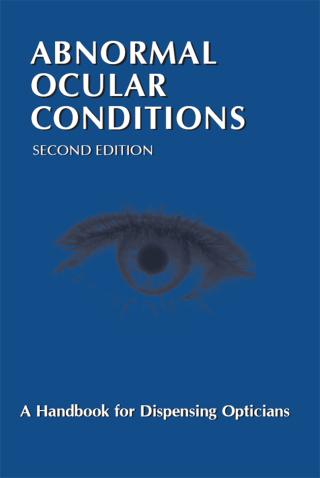 Omslagafbeelding: Abnormal Ocular Conditions: A Handbook for Dispensing Opticians 2nd edition 9780900099373