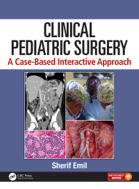 Titelbild: Clinical Pediatric Surgery 1st edition 9781498710336