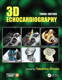 Titelbild: 3D Echocardiography 3rd edition 9780367252885