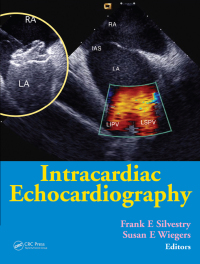 Cover image: Intracardiac Echocardiography 1st edition 9781841844800