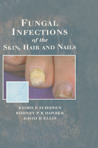 صورة الغلاف: Fungal Infections of the Skin and Nails 1st edition 9781853175893