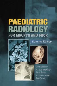 Cover image: Paediatric Radiology for MRCPCH and FRCR, Second Edition 2nd edition 9781138372887