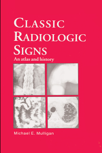 Imagen de portada: Classic Radiologic Signs 1st edition 9781850706649