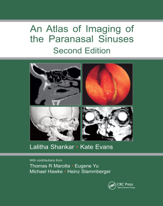 Cover image: Atlas of Imaging of the Paranasal Sinuses, Second Edition 2nd edition 9781841844480