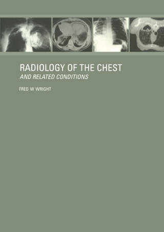 Cover image: Radiology of the Chest and Related Conditions 1st edition 9780415281416