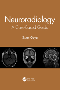 Cover image: Neuroradiology 1st edition 9780367548001