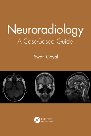 Cover image: Neuroradiology 1st edition 9780367548001