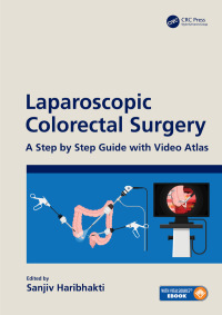 صورة الغلاف: Laparoscopic Colorectal Surgery 1st edition 9780367352844