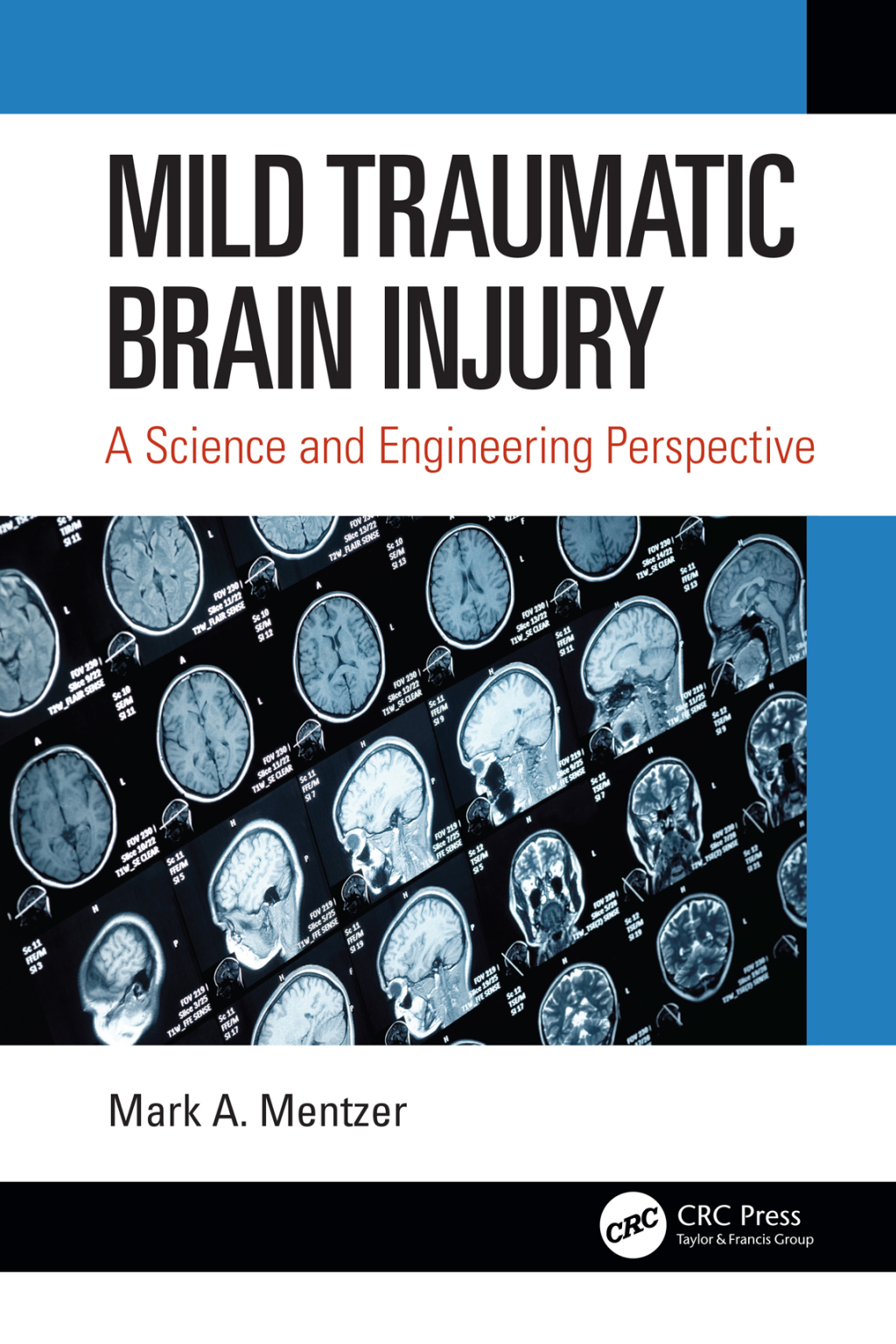 Mild Traumatic Brain Injury A Science and Engineering Perspective 1st Edition
