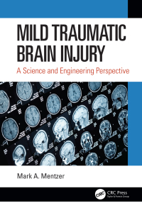 Immagine di copertina: Mild Traumatic Brain Injury 1st edition 9780367362607