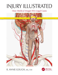 Cover image: Injury Illustrated 1st edition 9780367524173