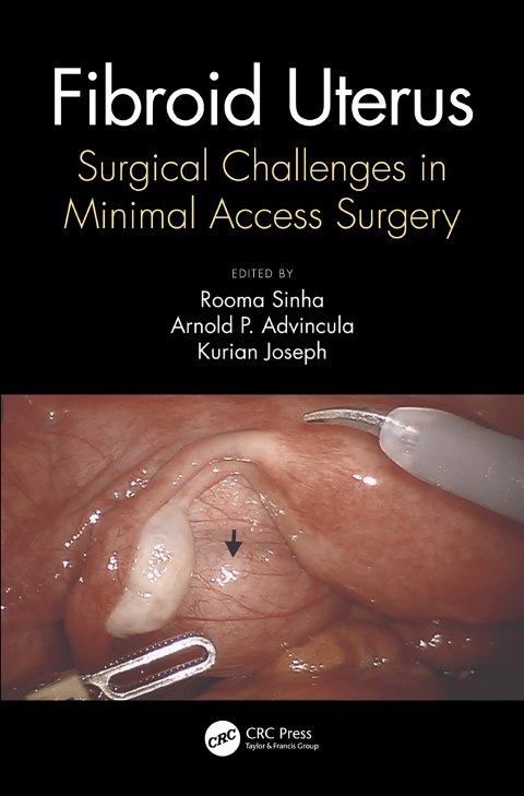 Fibroid Uterus: Surgical Challenges in Minimal Access Surgery, 1st Edition - FULL INSTANT DOWNLOAD | PDF DOCX EPUB