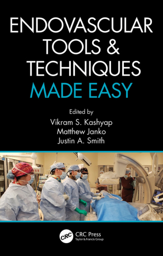 Cover image: Endovascular Tools and Techniques Made Easy 1st edition 9780367279899