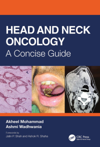 Cover image: Head and Neck Oncology 1st edition 9780367421311
