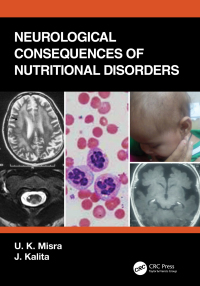 Imagen de portada: Neurological Consequences of Nutritional Disorders 1st edition 9780367313449