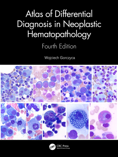 Atlas of Differential Diagnosis in Neoplastic Hematopathology, 4th Edition - FULL INSTANT DOWNLOAD | PDF DOCX EPUB