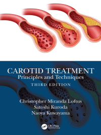 表紙画像: Carotid Treatment: Principles and Techniques 3rd edition 9780367465711
