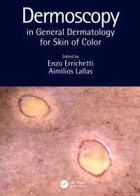 Immagine di copertina: Dermoscopy in General Dermatology for Skin of Color 1st edition 9781032068602
