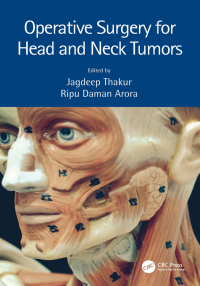 Titelbild: Operative Surgery for Head and Neck Tumors 1st edition 9780367430122