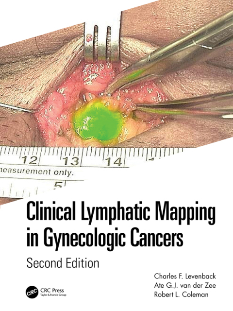 Clinical Lymphatic Mapping in Gynecologic Cancers, 2nd Edition - FULL INSTANT DOWNLOAD | PDF DOCX EPUB