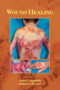 Cover image: Wound Healing 1st edition 9780824754587