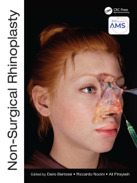 Cover image: Non-Surgical Rhinoplasty 1st edition 9781032303444