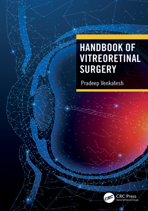 Handbook of Vitreoretinal Surgery, 1st Edition - FULL INSTANT DOWNLOAD | PDF DOCX EPUB
