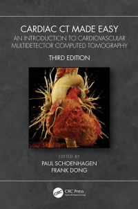Cover image: Cardiac CT Made Easy 3rd edition 9780367721480