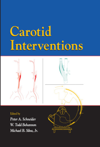 Cover image: Carotid Interventions 1st edition 9780367454333