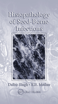 Immagine di copertina: Histopathology of Seed-Borne Infections 1st edition 9780367454357