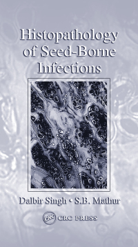 Cover image: Histopathology of Seed-Borne Infections 1st edition 9780367454357