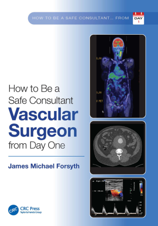 Immagine di copertina: How to be a Safe Consultant Vascular Surgeon from Day One 1st edition 9781032285474