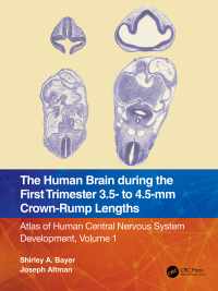 Omslagafbeelding: The Human Brain during the First Trimester 3.5- to 4.5-mm Crown-Rump Lengths 1st edition 9781032183268