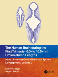 Imagen de portada: The Human Brain during the First Trimester 6.3- to 10.5-mm Crown-Rump Lengths 1st edition 9781032183275