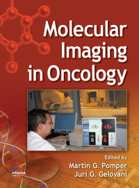 Cover image: Molecular Imaging in Oncology 1st edition 9780367403485