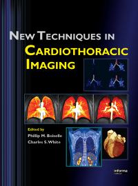 Cover image: New Techniques in Cardiothoracic Imaging 1st edition 9780367452964