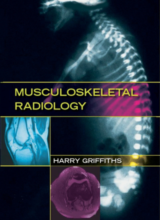 Imagen de portada: Musculoskeletal Radiology 1st edition 9780367452612