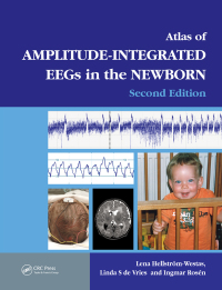 Titelbild: An Atlas of Amplitude-Integrated EEGs in the Newborn 2nd edition 9781841846491