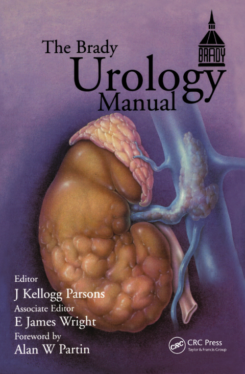 Brady Urology Manual, 1st Edition - FULL INSTANT DOWNLOAD | PDF DOCX EPUB