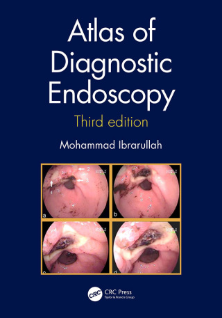 Cover image: Atlas of Diagnostic Endoscopy, 3E 3rd edition 9781032473598