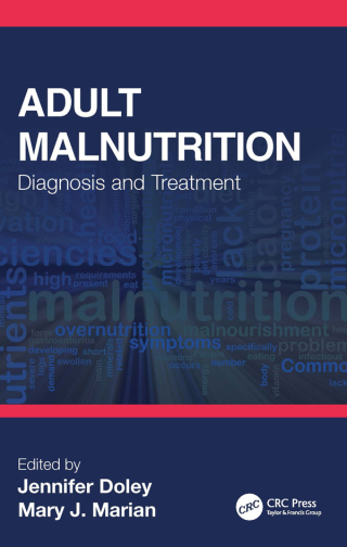 Titelbild: Adult Malnutrition 1st edition 9781032011868