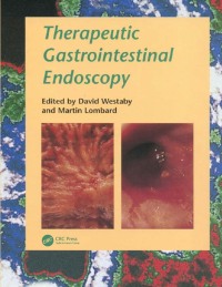 Cover image: Therapeutic Gastrointestinal Endoscopy 1st edition 9781899066957