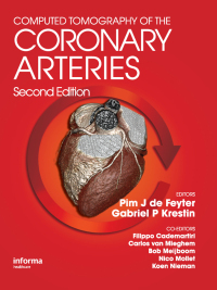 Titelbild: Computed Tomography of the Coronary Arteries 2nd edition 9781841846576