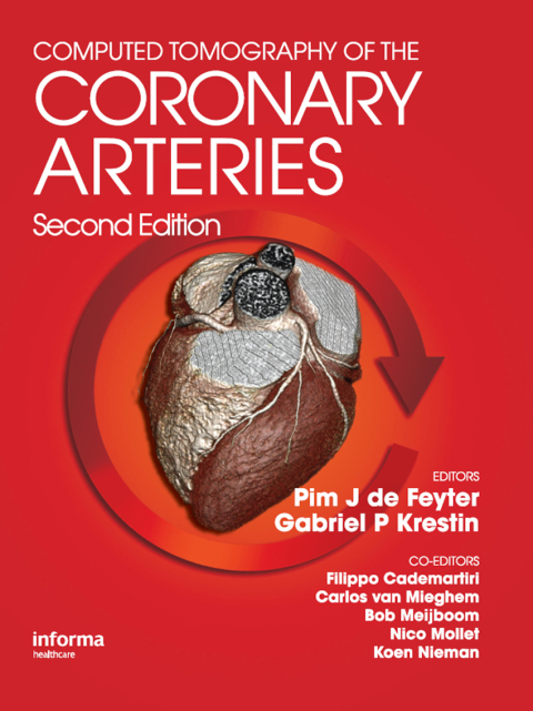 Computed Tomography of the Coronary Arteries, 2nd Edition - FULL INSTANT DOWNLOAD | PDF DOCX EPUB