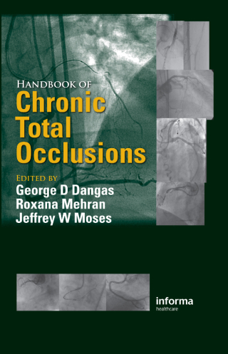 Cover image: Handbook of Chronic Total Occlusions 1st edition 9781841846248